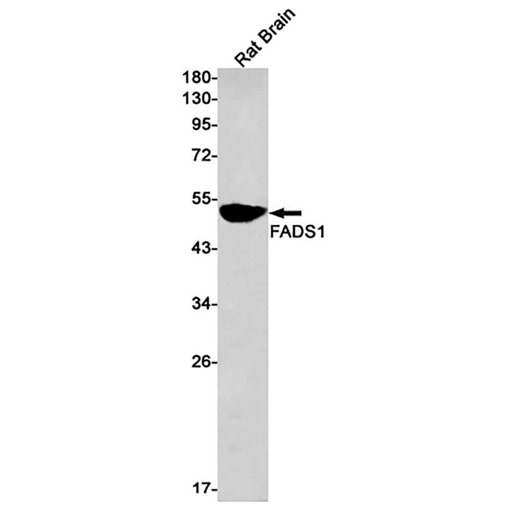 FADS1 (6Q19) Rabbit Monoclonal Antibody | 兔单抗 | EnkiLife恩玑生命