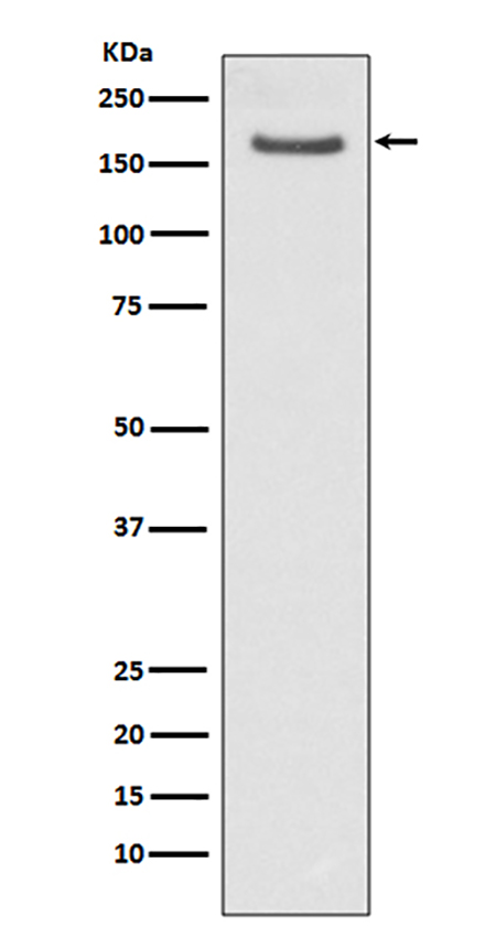 FANCD2 (16Q3) Rabbit Monoclonal Antibody | 兔单抗 | EnkiLife恩玑生命