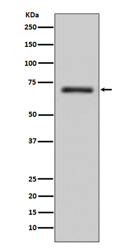 FUS / TLS (18I13) Rabbit Monoclonal Antibody | 兔单抗 | EnkiLife恩玑生命