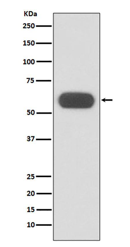 GBA (1P9) Rabbit Monoclonal Antibody | 兔单抗 | EnkiLife恩玑生命