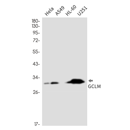 GCLM (6U5) Rabbit Monoclonal Antibody | 兔单抗 | EnkiLife恩玑生命