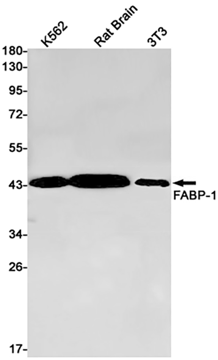 GOT2 (13J19) Rabbit Monoclonal Antibody | 兔单抗 | EnkiLife恩玑生命