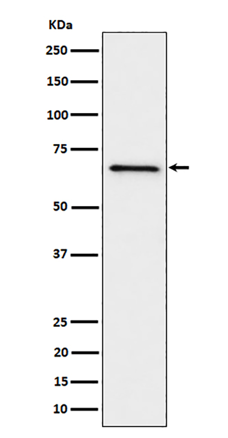 GRK6 (17B2) Rabbit Monoclonal Antibody | 兔单抗 | EnkiLife恩玑生命
