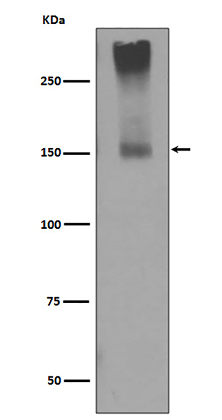 GRM5   (6R13) Rabbit Monoclonal Antibody | 兔单抗 | EnkiLife恩玑生命