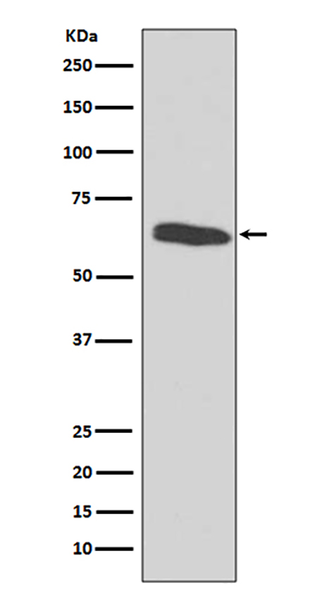 HDAC2 (7L9) Rabbit Monoclonal Antibody | 兔单抗 | EnkiLife恩玑生命