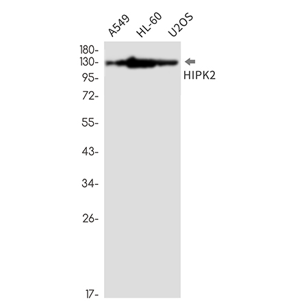 HIPK2 (14G18) Rabbit Monoclonal Antibody | 兔单抗 | EnkiLife恩玑生命