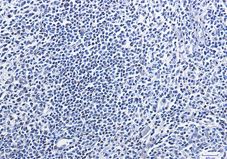 HMGB1 (2P7) Rabbit Monoclonal Antibody | 兔单抗 | EnkiLife恩玑生命