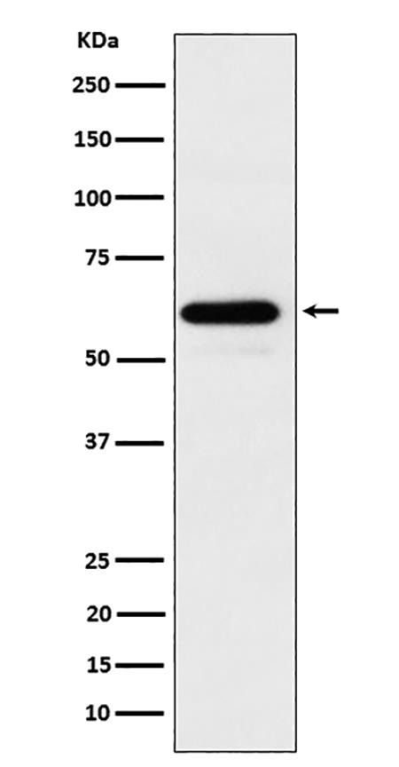 HRPT2 / CDC73 (19W5) Rabbit Monoclonal Antibody | 兔单抗 | EnkiLife恩玑生命