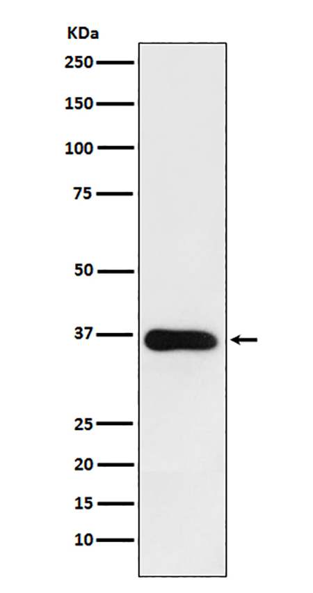 HSD11B1 (17P16) Rabbit Monoclonal Antibody | 兔单抗 | EnkiLife恩玑生命