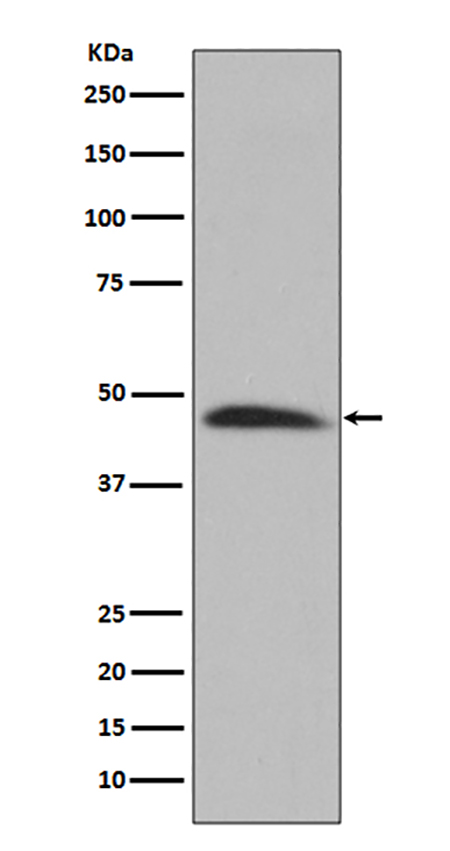 Hsp47 (18D10) Rabbit Monoclonal Antibody | 兔单抗 | EnkiLife恩玑生命