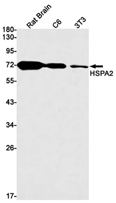 HSPA2 (15B13) Rabbit Monoclonal Antibody | 兔单抗 | EnkiLife恩玑生命