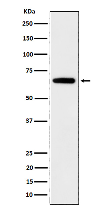 IGF2BP2 (13K3) Rabbit Monoclonal Antibody | 兔单抗 | EnkiLife恩玑生命