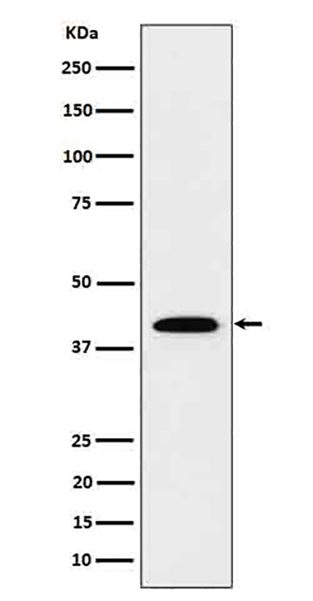 IL12B (2Q3) Rabbit Monoclonal Antibody | 兔单抗 | EnkiLife恩玑生命