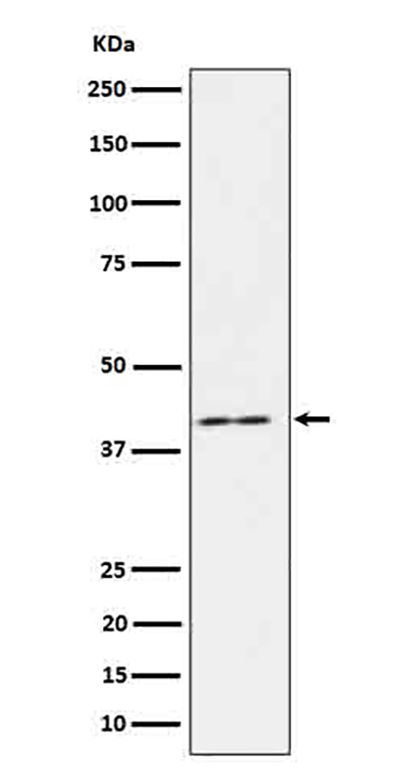 IL18 binding protein (18K17) Rabbit Monoclonal Antibody | 兔单抗 | EnkiLife恩玑生命
