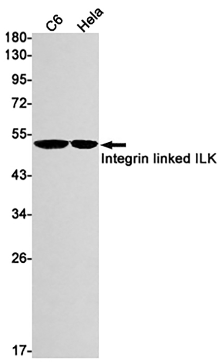 ILK (13L8) Rabbit Monoclonal Antibody | 兔单抗 | EnkiLife恩玑生命