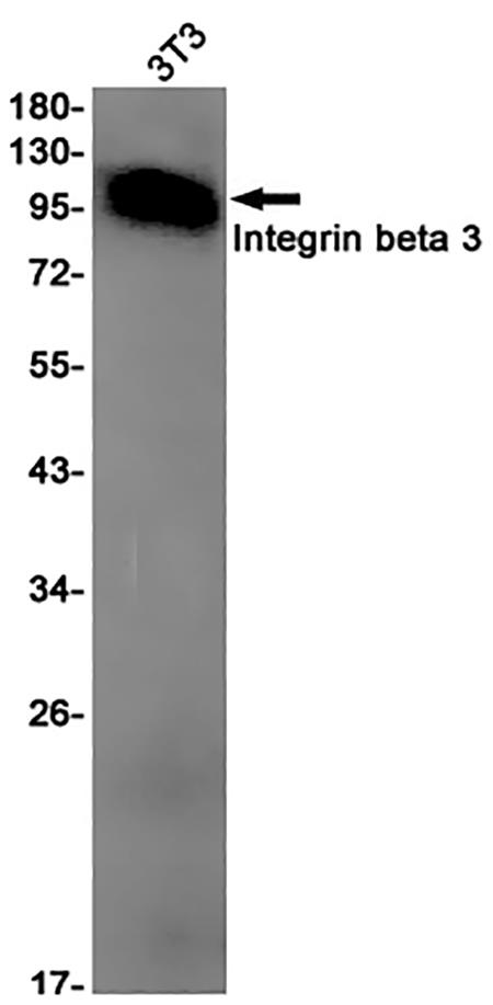 Integrin beta 3  (15D18) Rabbit Monoclonal Antibody | 兔单抗 | EnkiLife恩玑生命