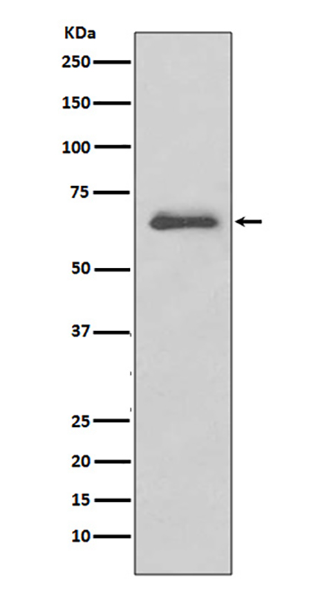 IRAK3 (17H10) Rabbit Monoclonal Antibody | 兔单抗 | EnkiLife恩玑生命