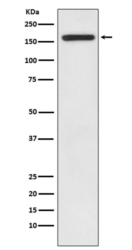 IRS1 (17G5) Rabbit Monoclonal Antibody | 兔单抗 | EnkiLife恩玑生命