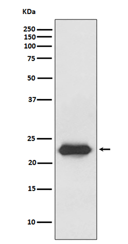 Lipocalin-2 (19M14) Rabbit Monoclonal Antibody | 兔单抗 | EnkiLife恩玑生命