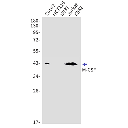 MCSF (11G12) Rabbit Monoclonal Antibody | 兔单抗 | EnkiLife恩玑生命