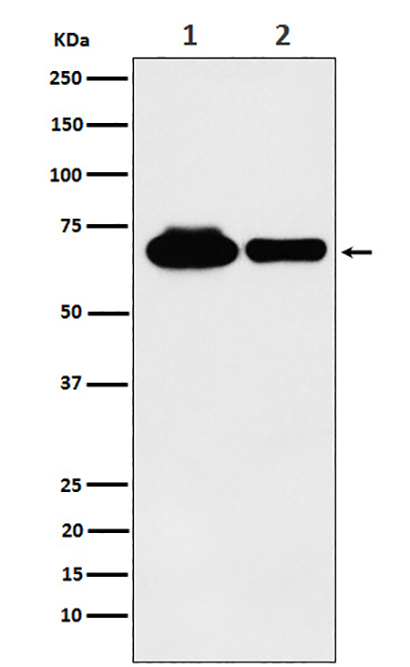METTL3 (18R12) Rabbit Monoclonal Antibody | 兔单抗 | EnkiLife恩玑生命