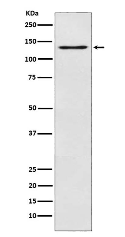 MGEA5 (10M9) Rabbit Monoclonal Antibody | 兔单抗 | EnkiLife恩玑生命