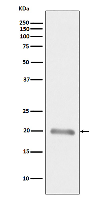 MLANA (10J15) Rabbit Monoclonal Antibody | 兔单抗 | EnkiLife恩玑生命
