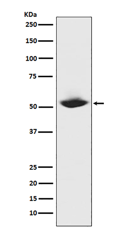 MMP1 (7R3) Rabbit Monoclonal Antibody | 兔单抗 | EnkiLife恩玑生命