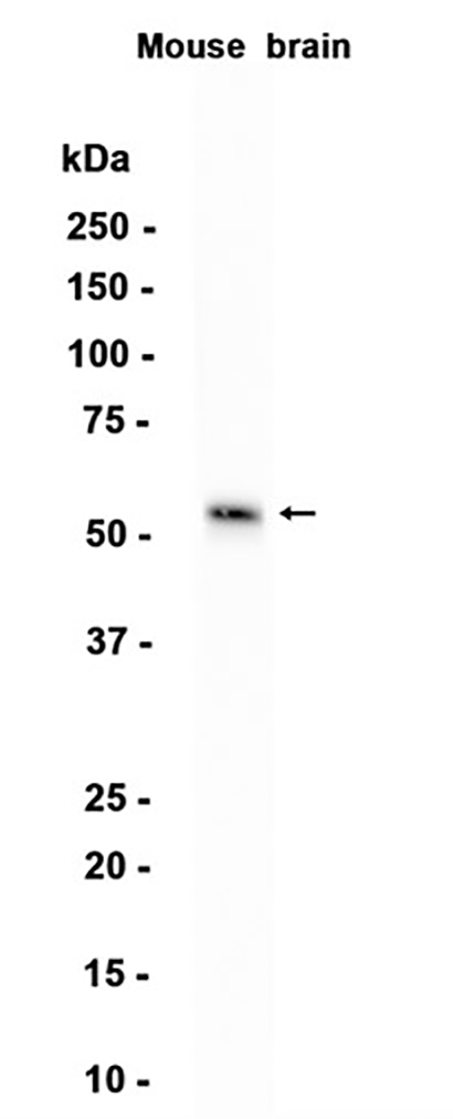 MMP17 (19A10) Rabbit Monoclonal Antibody | 兔单抗 | EnkiLife恩玑生命
