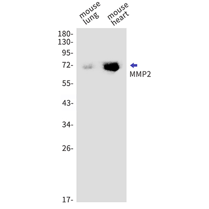 MMP2 (12D11) Rabbit Monoclonal Antibody | 兔单抗 | EnkiLife恩玑生命