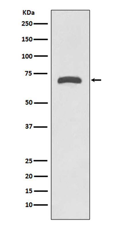 MMP8 (4B14) Rabbit Monoclonal Antibody | 兔单抗 | EnkiLife恩玑生命