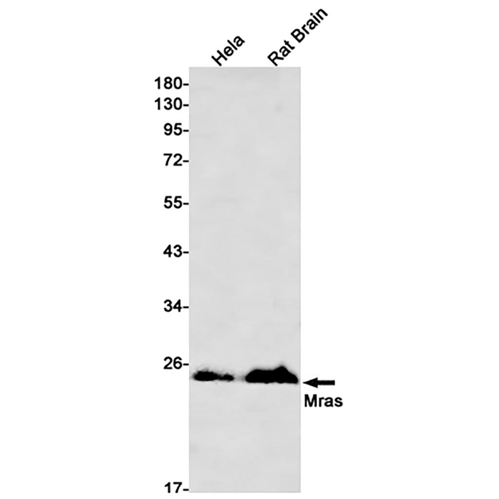 Mras (5X6) Rabbit Monoclonal Antibody | 兔单抗 | EnkiLife恩玑生命