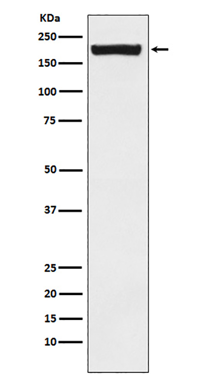 MRC2/ENDO180 (10A4) Rabbit Monoclonal Antibody | 兔单抗 | EnkiLife恩玑生命