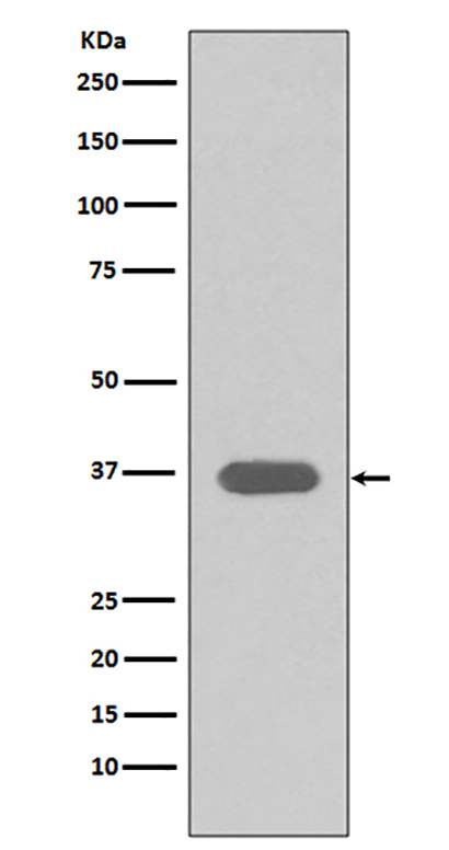 MSI2 (13U1) Rabbit Monoclonal Antibody | 兔单抗 | EnkiLife恩玑生命