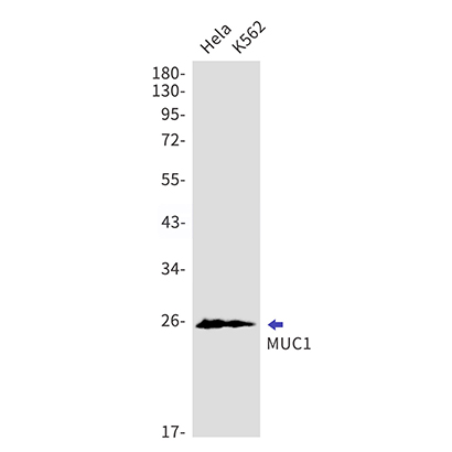 MUC1 (8S2) Rabbit Monoclonal Antibody | 兔单抗 | EnkiLife恩玑生命