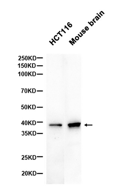 Musashi 1  (19M18) Rabbit Monoclonal Antibody | 兔单抗 | EnkiLife恩玑生命