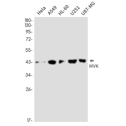 MVK (17J12) Rabbit Monoclonal Antibody | 兔单抗 | EnkiLife恩玑生命
