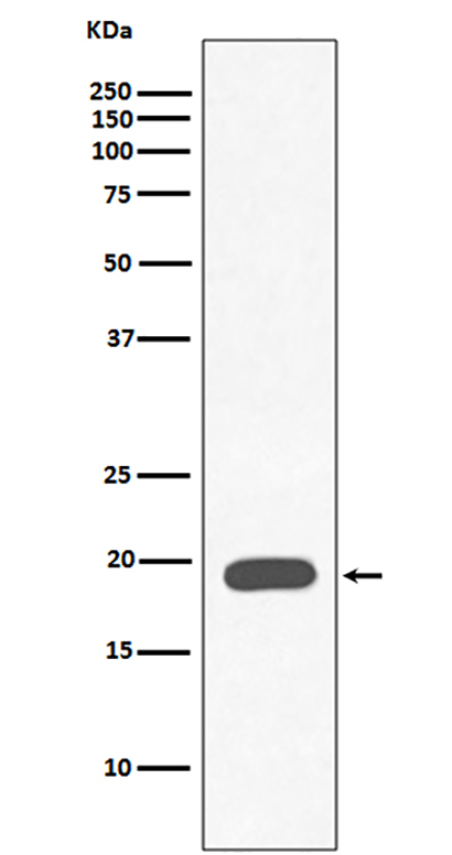 Myoglobin (17N17) Rabbit Monoclonal Antibody | 兔单抗 | EnkiLife恩玑生命