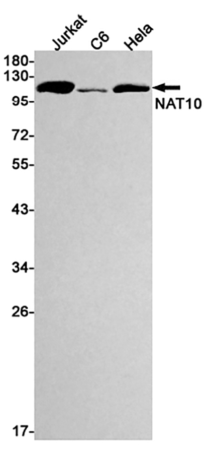NAT10 (7O15) Rabbit Monoclonal Antibody | 兔单抗 | EnkiLife恩玑生命