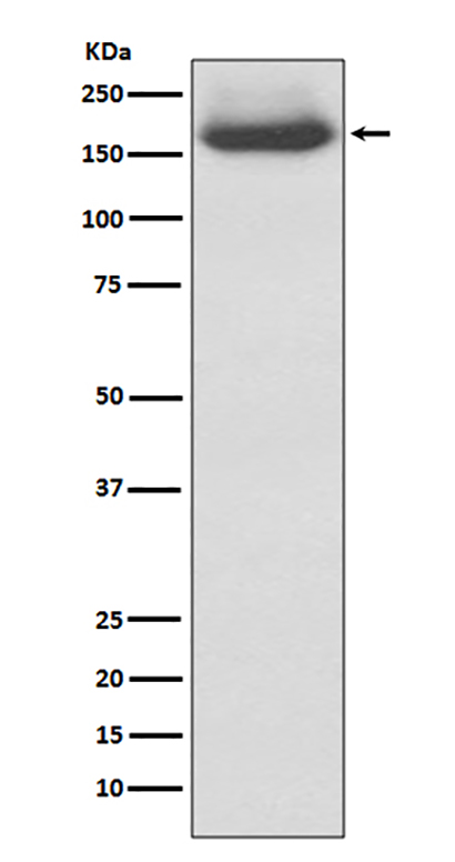 NEFM (5A2) Rabbit Monoclonal Antibody | 兔单抗 | EnkiLife恩玑生命