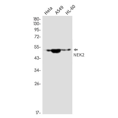 NEK2 (11H12) Rabbit Monoclonal Antibody | 兔单抗 | EnkiLife恩玑生命
