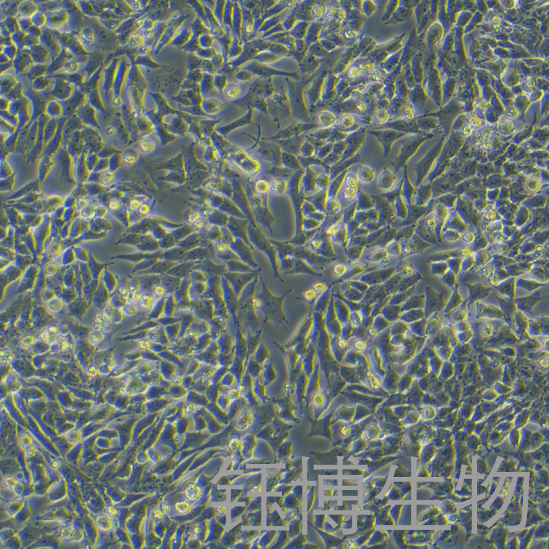 SNU-398（人肝癌细胞）YB-71816HC