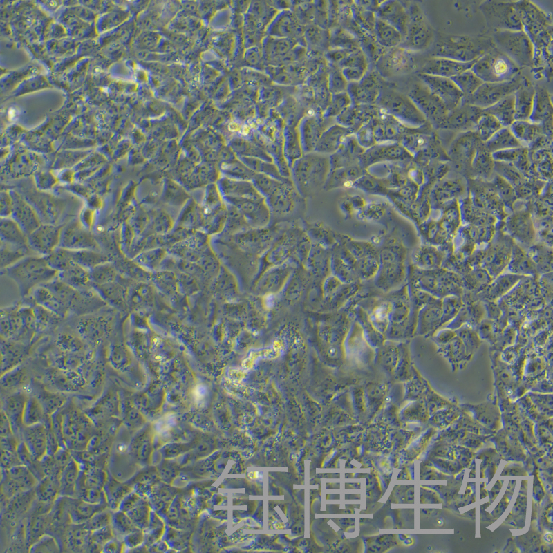 NTERA-2 cl.D1（人睾丸癌细胞）YB-71818HC