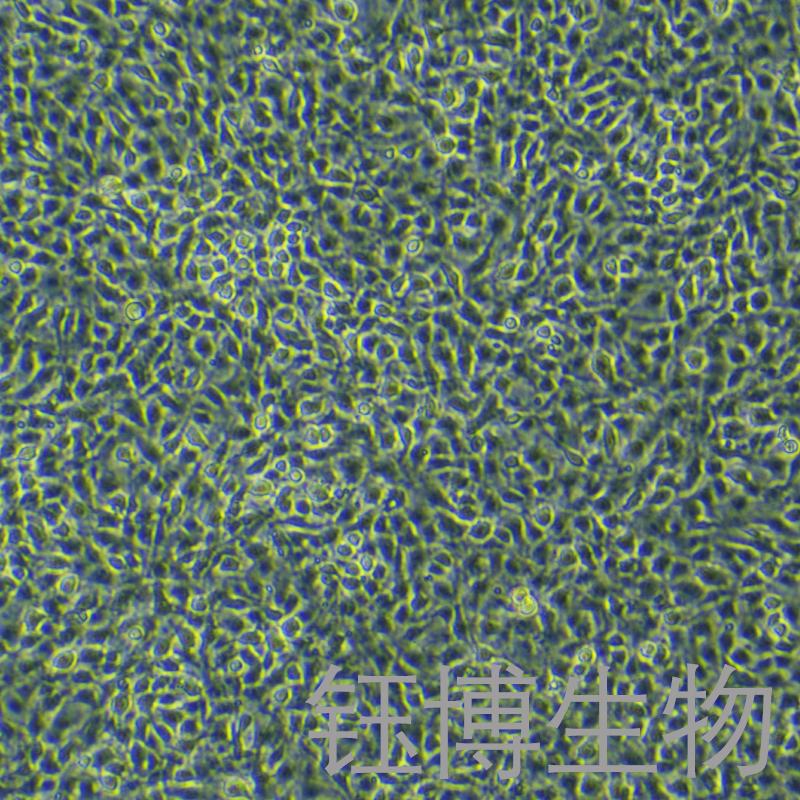 OLN-93（大鼠少突胶质前体细胞系）YB-7006RC