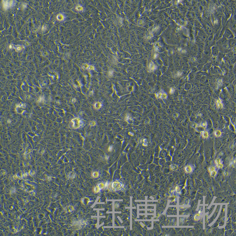 WSU-HN30（人口腔鳞状细胞）YB-71823HC