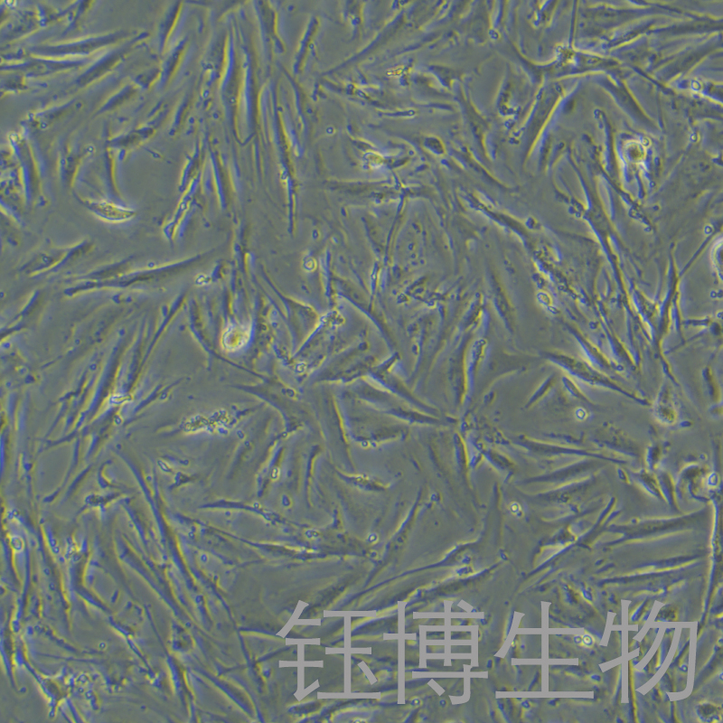 CCD841 CON（人正常结肠上皮细胞）YB-71820HC