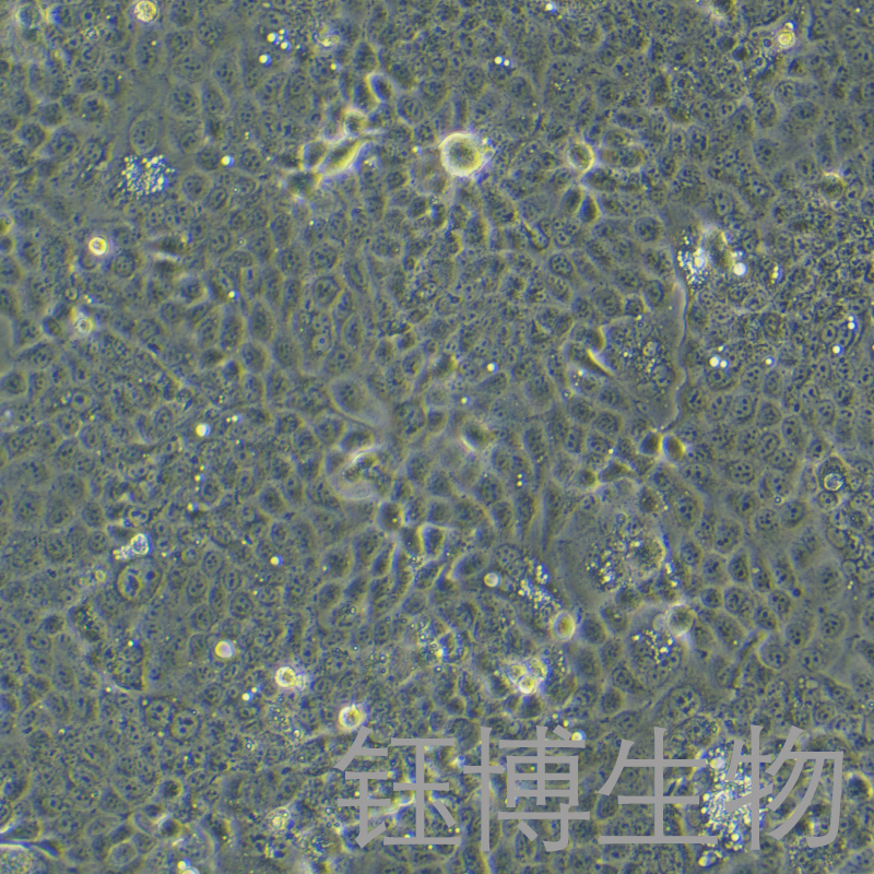 OE-33（人食管腺癌细胞）YB-71821HC