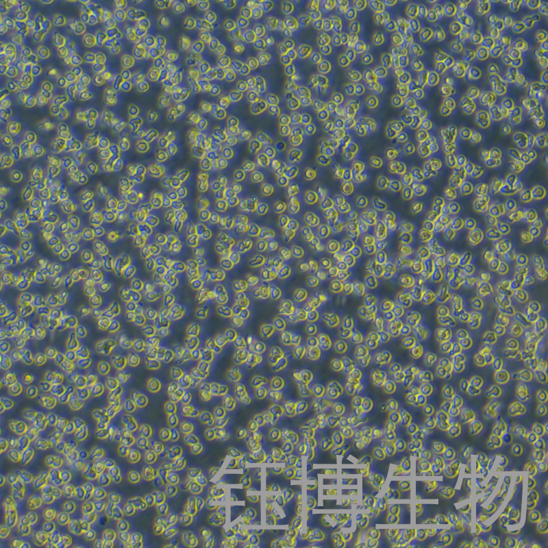 OCI-LY19（人B细胞淋巴瘤）YB-71829HC