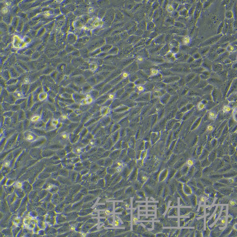 HBMEC（人脑微血管内皮细胞）YB-71830HC
