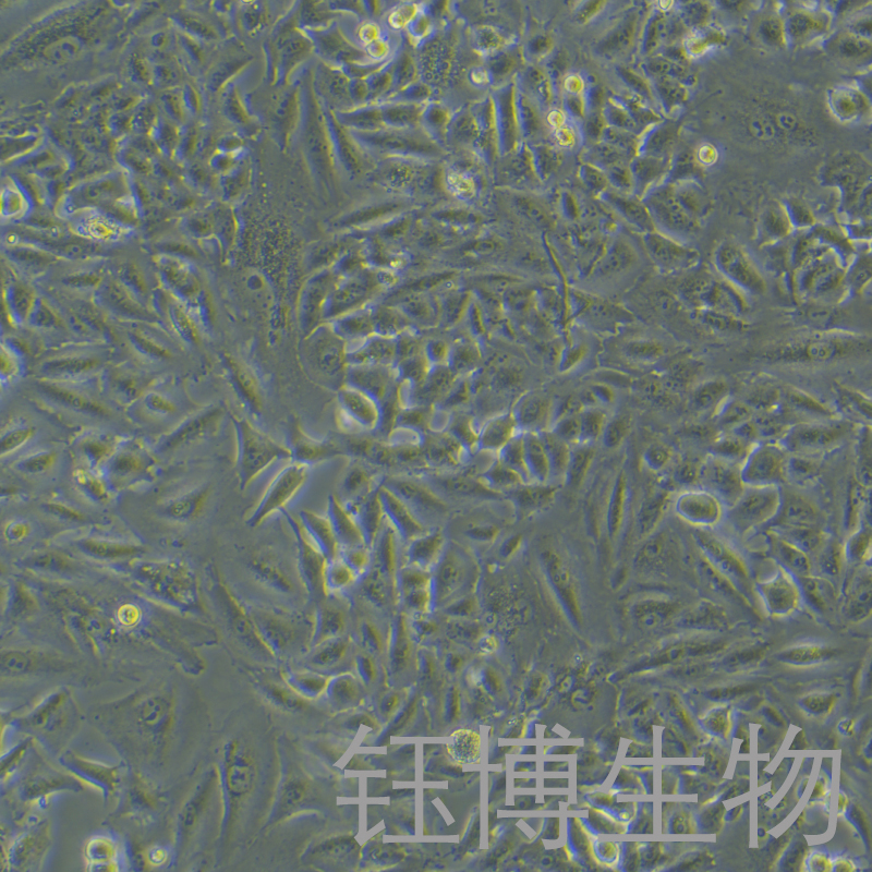 A549+LUC（人非小细胞肺癌细胞-荧光素酶标记）YB-71838HC-L